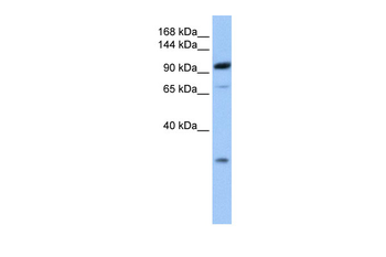 AP2B1 Rabbit Polyclonal Antibody