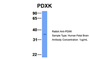 PDXK Rabbit Polyclonal Antibody
