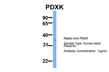 PDXK Rabbit Polyclonal Antibody