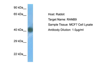 RANBP9 Rabbit Polyclonal Antibody
