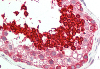 HSPA1L Rabbit Polyclonal Antibody