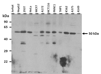 TUBA3C Rabbit Polyclonal Antibody