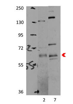 PRKAA1 Rabbit Polyclonal Antibody