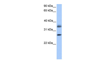 LGALS8 Rabbit Polyclonal Antibody