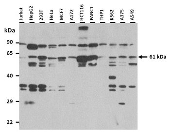 ISYNA1 Rabbit Polyclonal Antibody