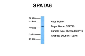 SPATA6 Rabbit Polyclonal Antibody