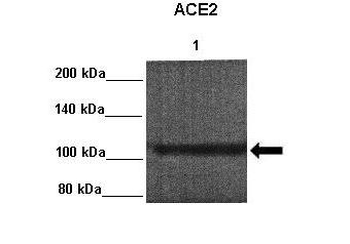 ACE2 Rabbit Polyclonal Antibody