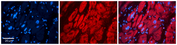 PRKAA1 Rabbit Polyclonal Antibody