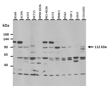 ULK1 Rabbit Polyclonal Antibody