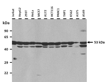 EPHX1 Rabbit Polyclonal Antibody
