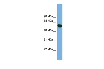EPHX1 Rabbit Polyclonal Antibody