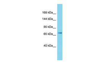 JAK3 Rabbit Polyclonal Antibody