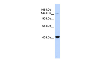 JAK3 Rabbit Polyclonal Antibody