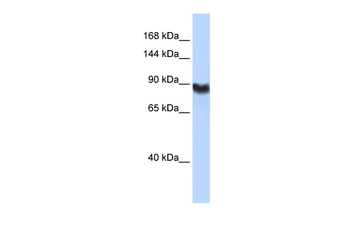 LIG1 Rabbit Polyclonal Antibody