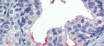 AMH Rabbit Polyclonal Antibody