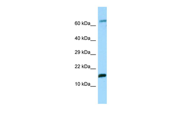 Hbe1 Rabbit Polyclonal Antibody