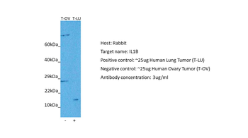 IL1B Rabbit Polyclonal Antibody