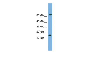 IL1B Rabbit Polyclonal Antibody