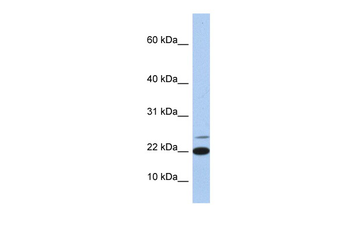 IL4 Rabbit Polyclonal Antibody