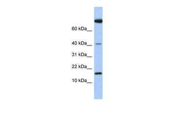 IL4 Rabbit Polyclonal Antibody