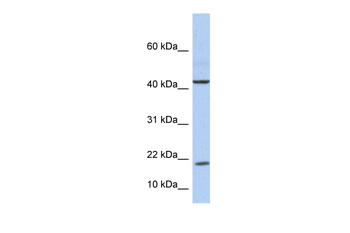 IL9 Rabbit Polyclonal Antibody