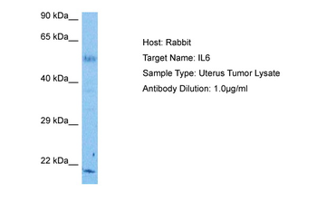 IL6 Rabbit Polyclonal Antibody