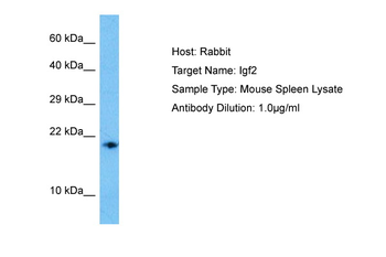 IGF2 Rabbit Polyclonal Antibody