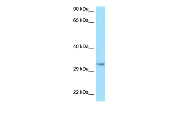 IGF2 Rabbit Polyclonal Antibody