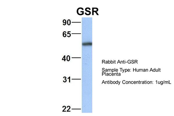 GSR Rabbit Polyclonal Antibody