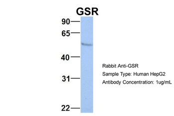 GSR Rabbit Polyclonal Antibody