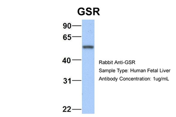 GSR Rabbit Polyclonal Antibody