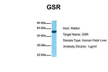GSR Rabbit Polyclonal Antibody