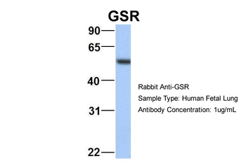 GSR Rabbit Polyclonal Antibody