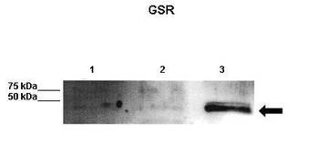 GSR Rabbit Polyclonal Antibody