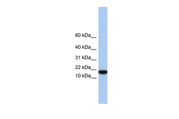 IL5 Rabbit Polyclonal Antibody