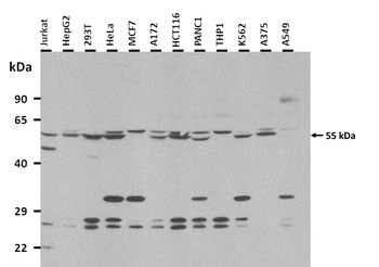 IMPDH1 Rabbit Polyclonal Antibody