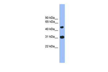 FAM13C1 Rabbit Polyclonal Antibody