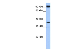 DCUN1D4 Rabbit Polyclonal Antibody