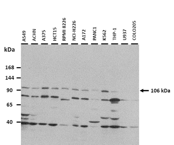 TRAK1 Rabbit Polyclonal Antibody