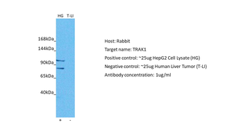 TRAK1 Rabbit Polyclonal Antibody