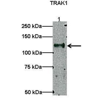 TRAK1 Rabbit Polyclonal Antibody