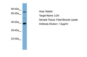LCK Rabbit Polyclonal Antibody