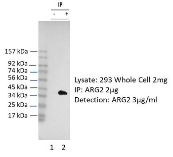ARG2 Rabbit Polyclonal Antibody