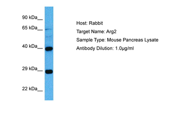 ARG2 Rabbit Polyclonal Antibody