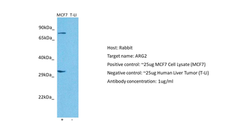 ARG2 Rabbit Polyclonal Antibody