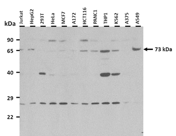 GCLC Rabbit Polyclonal Antibody