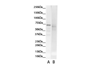 GCLC Rabbit Polyclonal Antibody