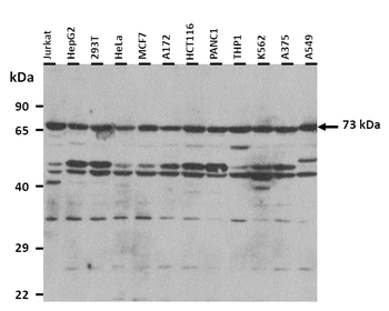 GCLC Rabbit Polyclonal Antibody