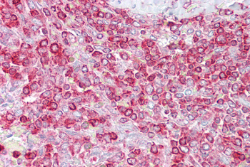 GCLC Rabbit Polyclonal Antibody