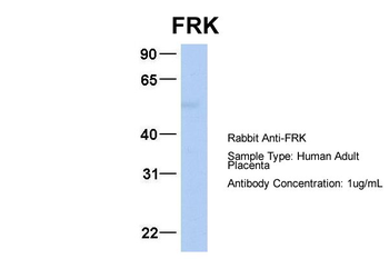 FRK Rabbit Polyclonal Antibody